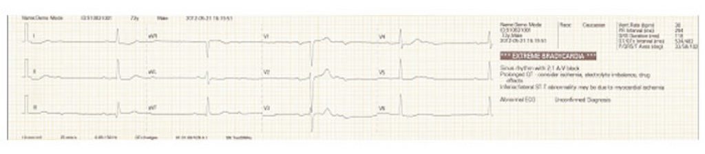 Bene Heart R3 A Bene Heart R3 A